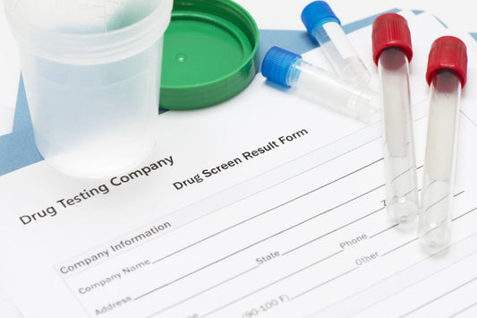 Does CBN Show Up In A Drug Test?